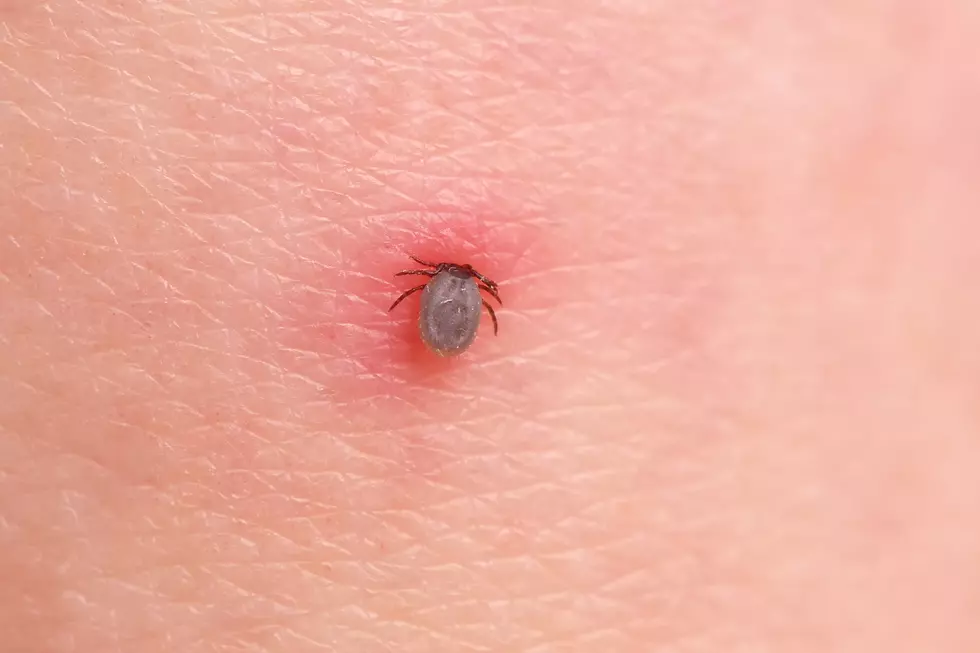 Common Tick Removal Mistakes Experts Say Could Cause You Big Problems